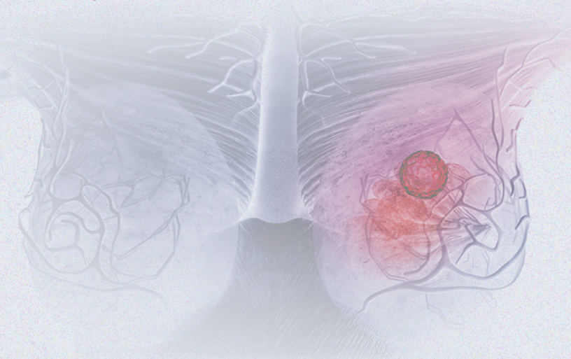 國(guó)際婦女節(jié) | 關(guān)注乳腺癌 微創(chuàng)介入讓美麗繼續(xù)，「乳」愿以償正成為現(xiàn)實(shí)