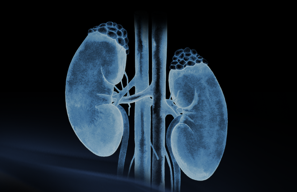 世界腎臟日 | 相得「腎」歡，融有術(shù)、精準(zhǔn)適形